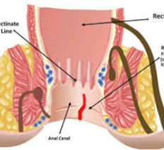 Doctors For Anorectal Disorder